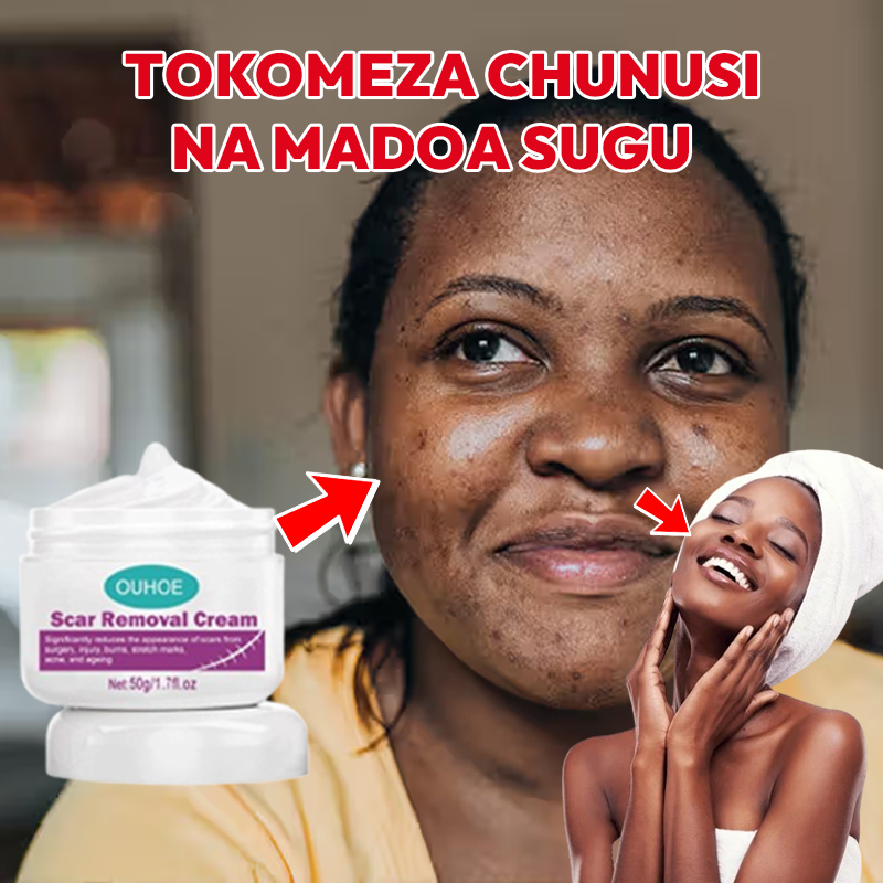 Scar Removal Cream 100% Natural L-650