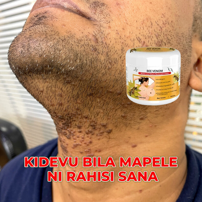 Warts Removal Cream care 100%