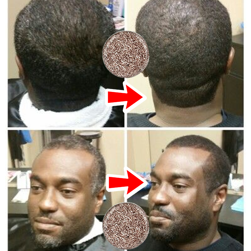 Hair shampoo Soap 100%