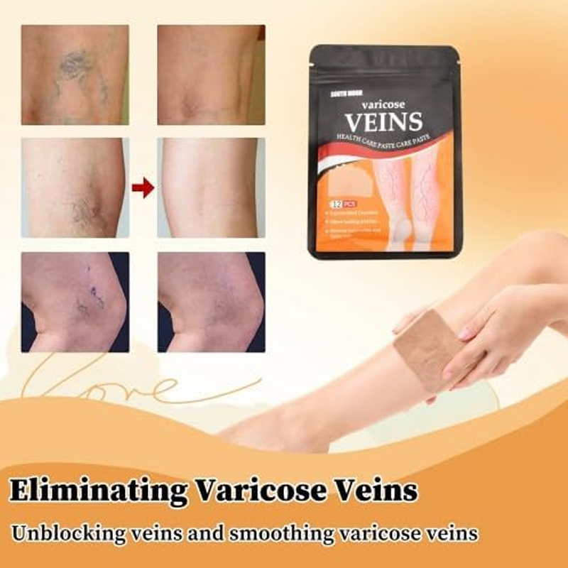 Varicose Veins Health Care Paste