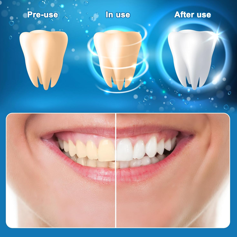 Teeth Whitening Strips