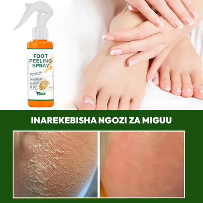 Foot Peeling Spray