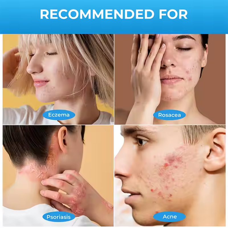 Herbal Skin Spray