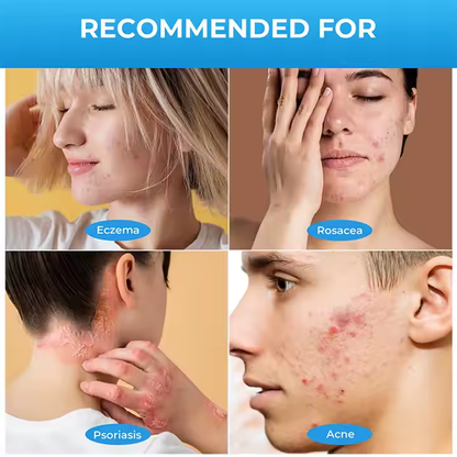 Herbal Skin Spray