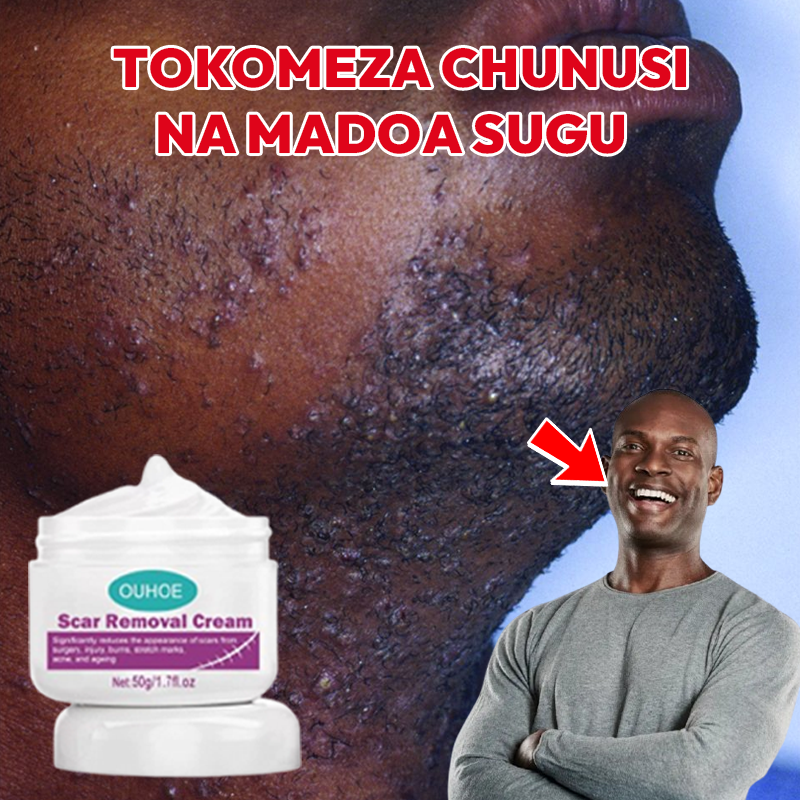 Scar Removal Cream 100% Natural L-516
