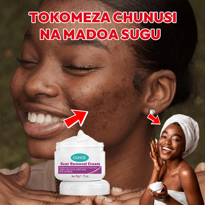Scar removal cream 100% Guarantee