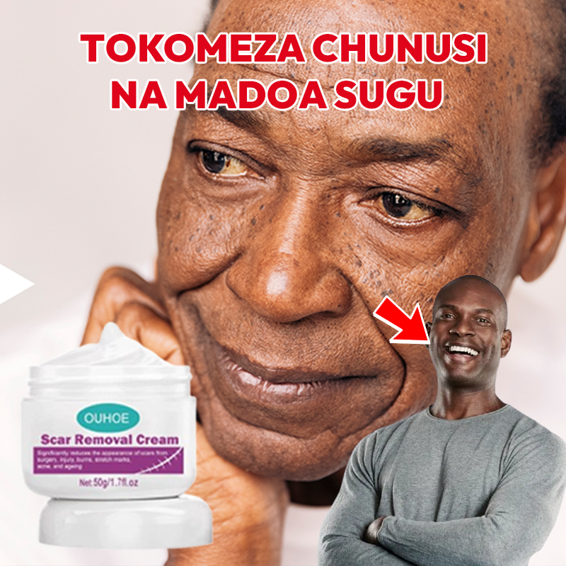 Scar Removal Cream 100% soft skin