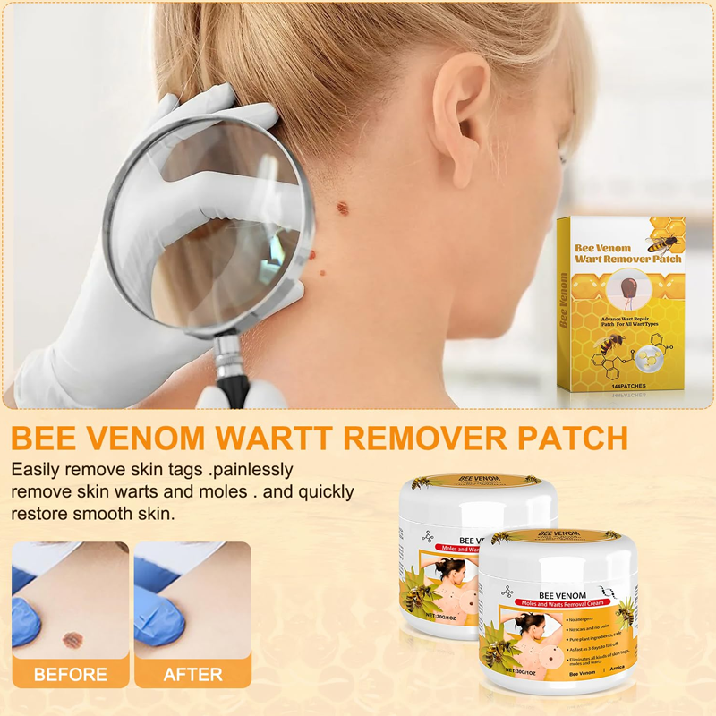 Warts Removal Cream guarantee