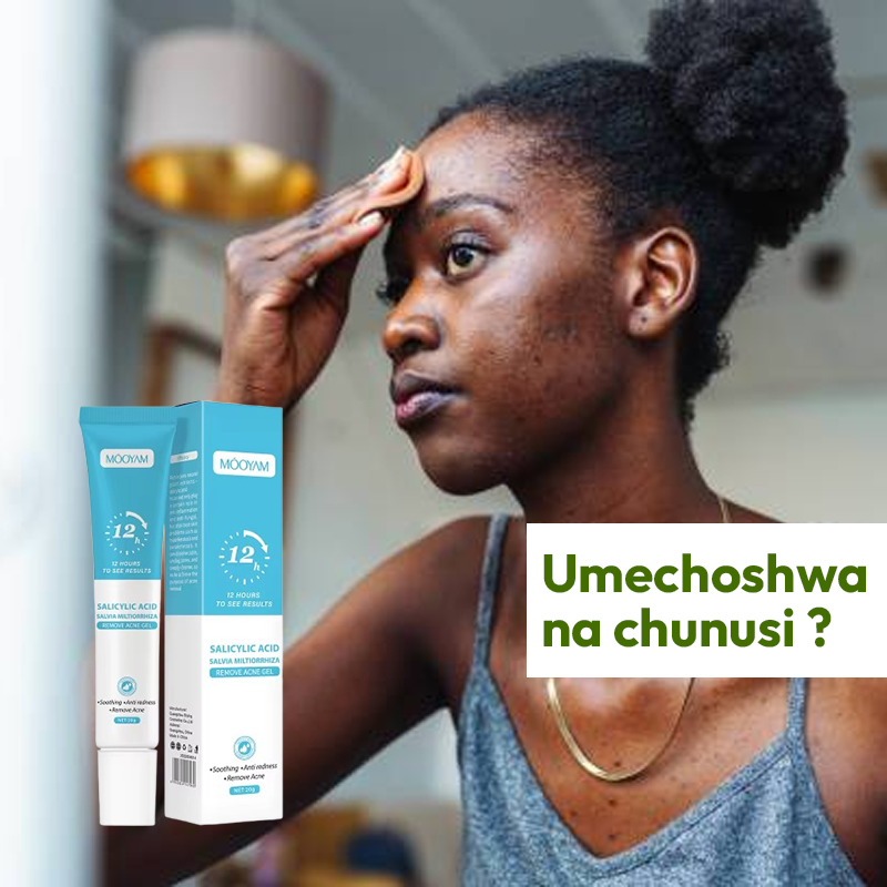 Acne Gel 100% Natural