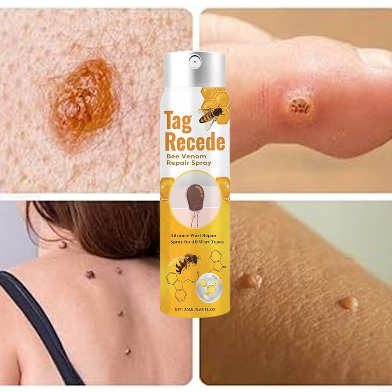 Warts removal spray 100% Natural