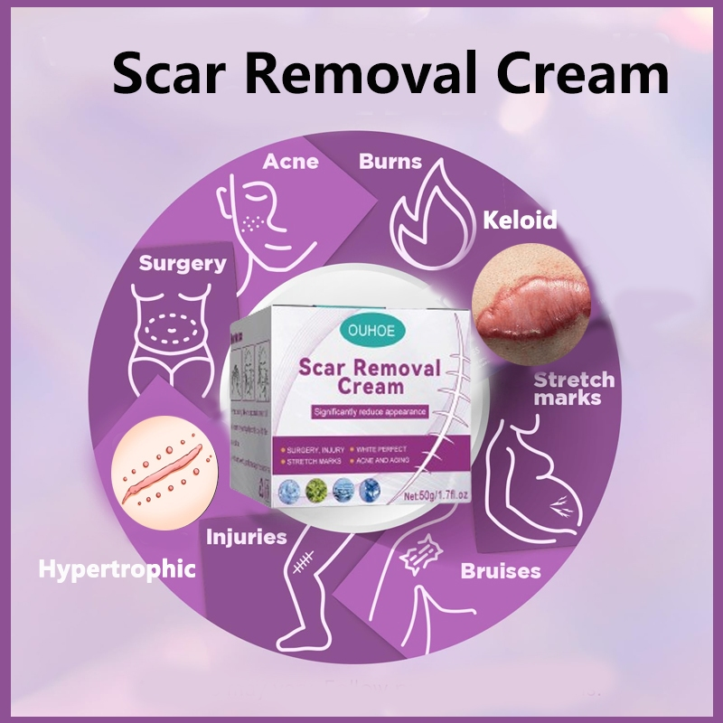 Scar Removal Cream