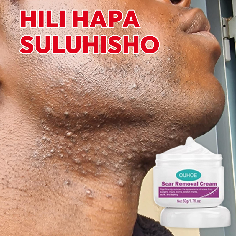 Scar Removal Cream 100% Natural pure