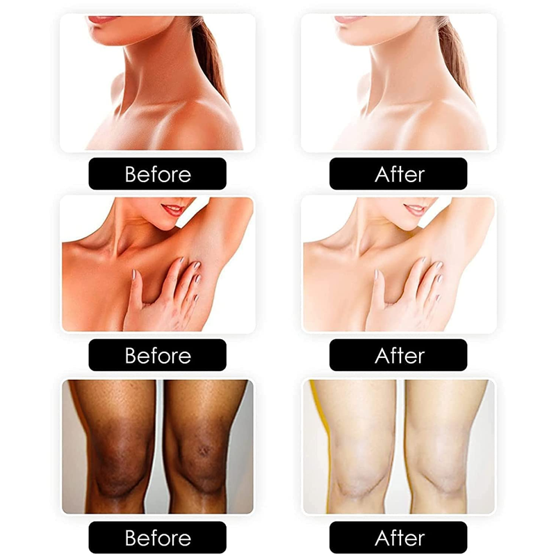 Body Whitening Soap