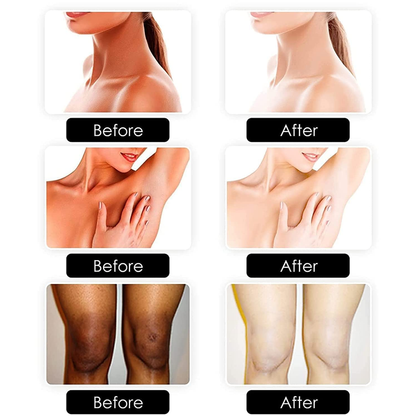Body Whitening Soap