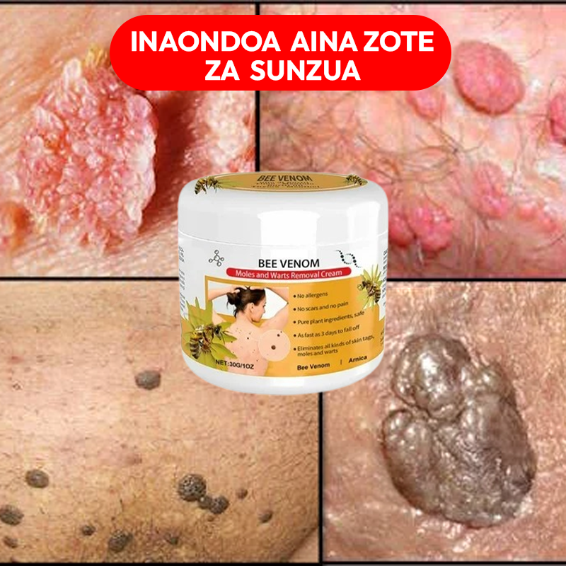 Warts Removal Cream 100% Natural.