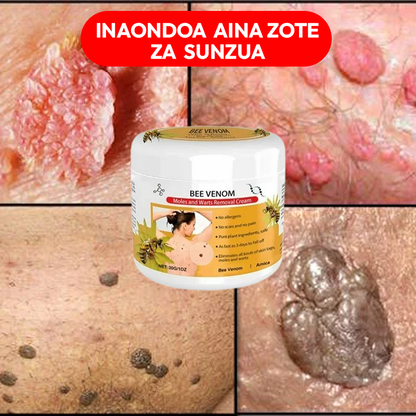 Warts Removal Cream 100% Natural.
