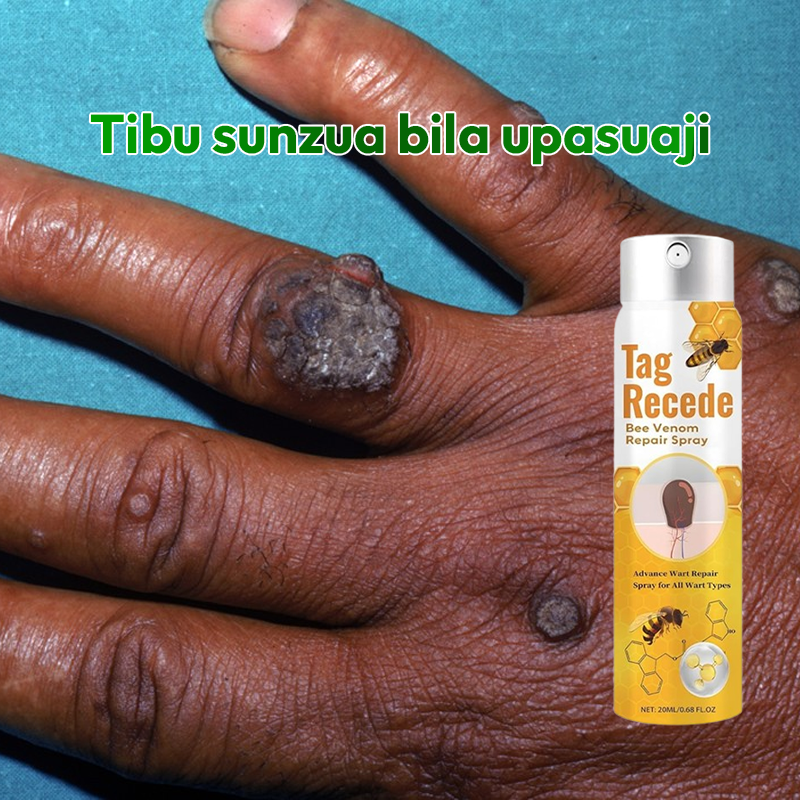 Warts Removal Spray 100% Natural*