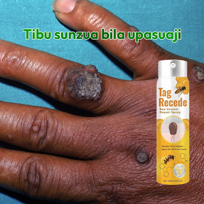 Warts Removal Spray 100% Natural*