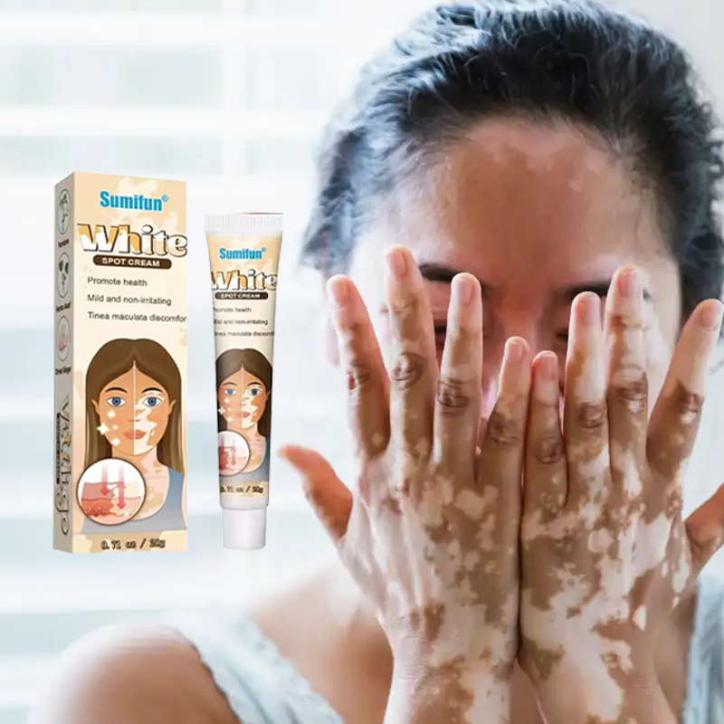 White Spot Cream