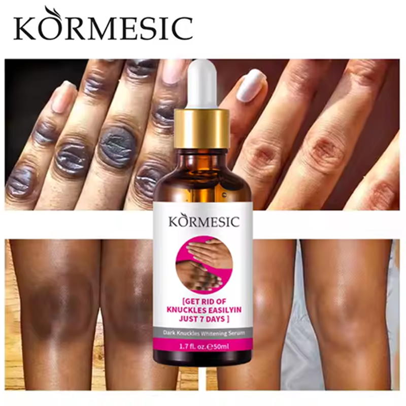 Knuckle Whitening Serum