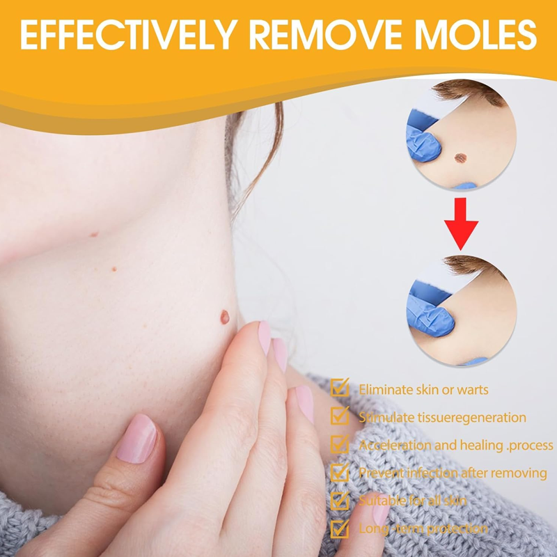 Warts Removal Cream fast results