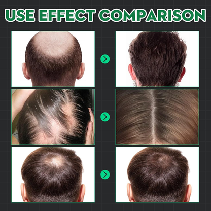 Hair Treatment