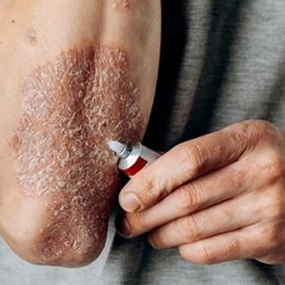 Herbal Skin Spray