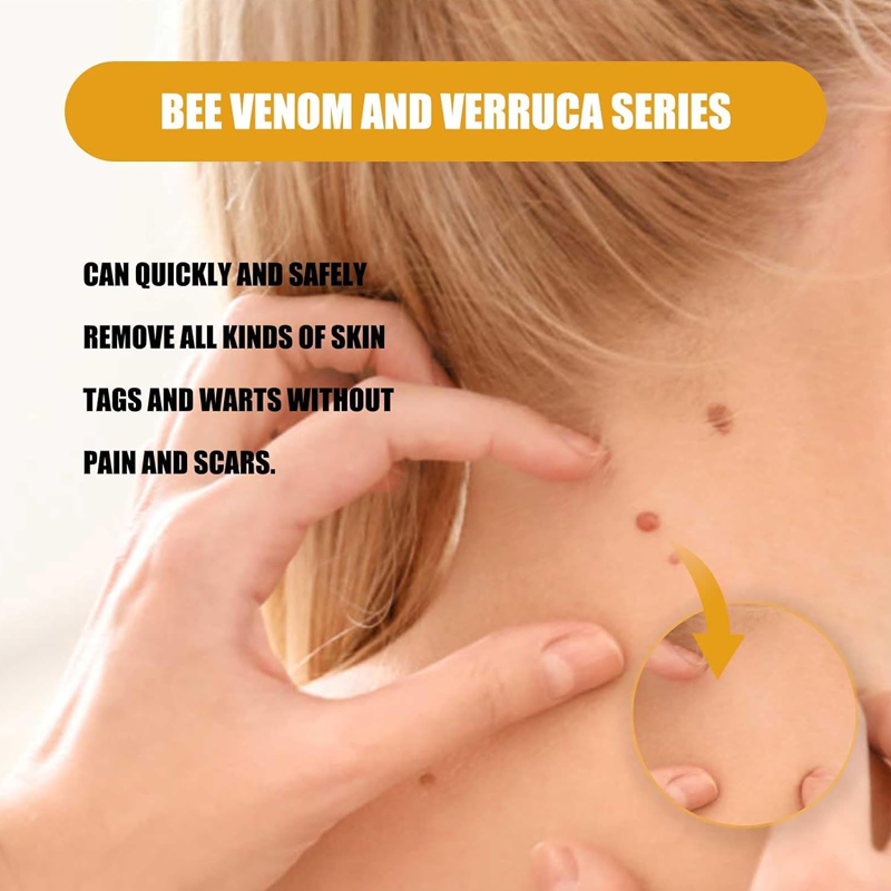 Warts Removal Cream fast results