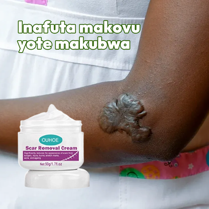 Scar removal cream Natural 100%