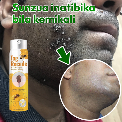 Warts Removal Spray 100% Guarantee