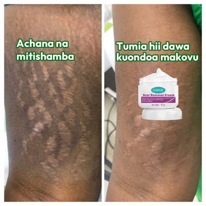 Scar Removal Cream 100% Natural guarantee