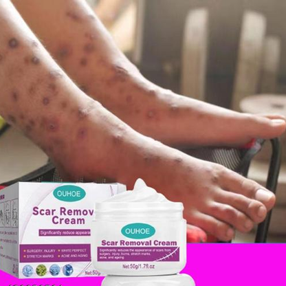 Scar Removal Cream