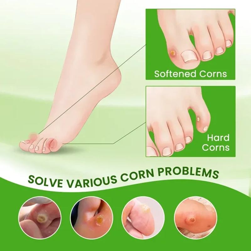 Foot Corn Remover