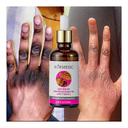 Knuckle Whitening Serum