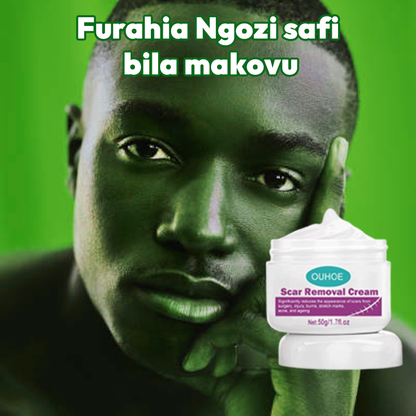 Scar Removal Cream nw