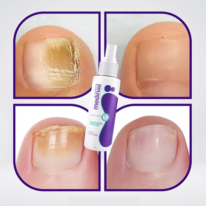 Nail Spray 100% Natural