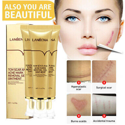 Scar Removal Cream