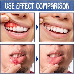 Toothache Spray