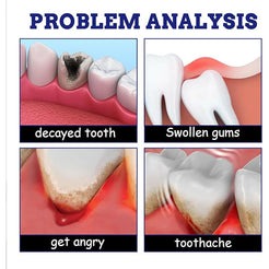 Toothache Spray